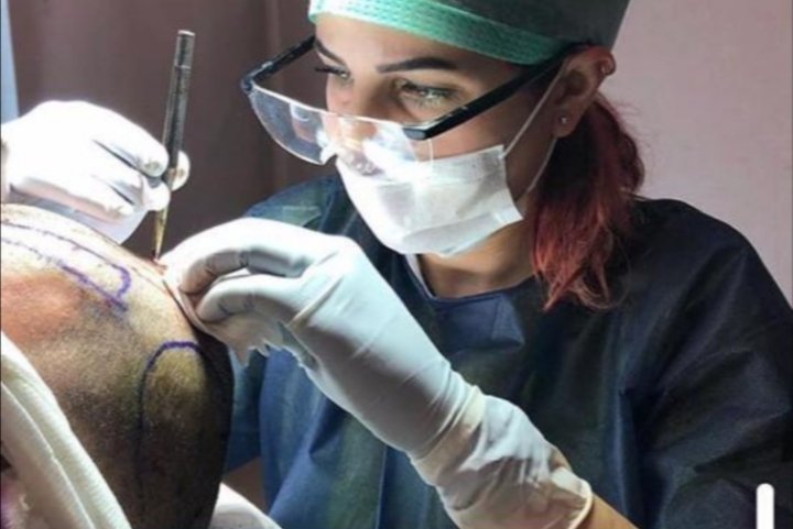 زراعة الشعر بدون حلاقة حصرياً في مركز Estepera - صورة مميزة صورة مميزة: زراعة الشعر بدون حلاقة حصرياً في مركز Estepera