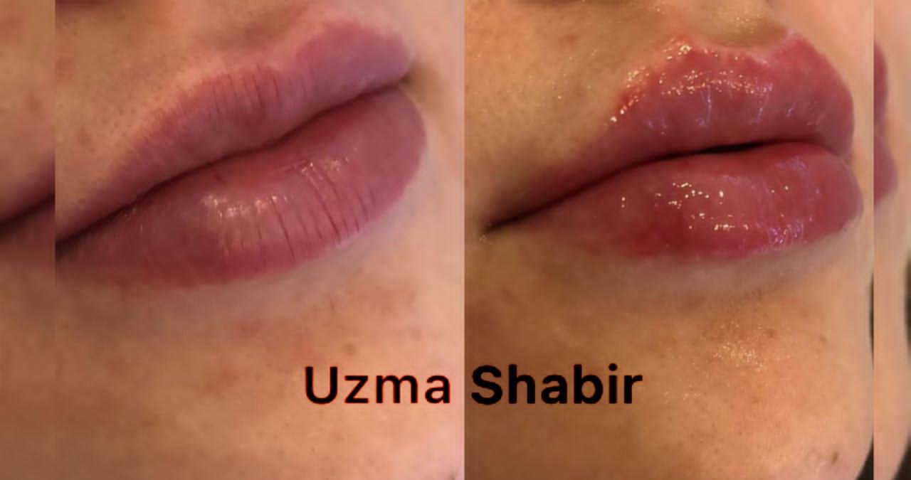 صورة مميزة: خبيرة التجميل عظمي شبير/ Uzma Shbr تشارك المتابعين مجموعة Reels لافتة