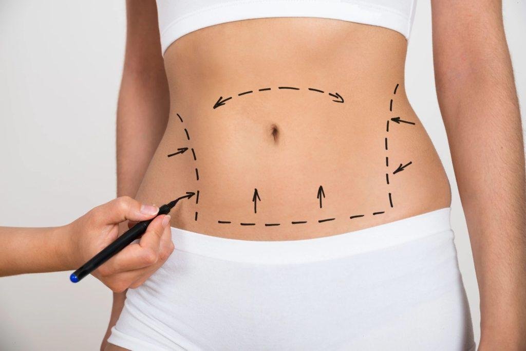دكتور التجميل علي عبد علي يتحدث عن عملية شفط الدهون - صورة مميزة صورة مميزة: دكتور التجميل علي عبد علي يتحدث عن عملية شفط الدهون